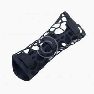 Prosthesis